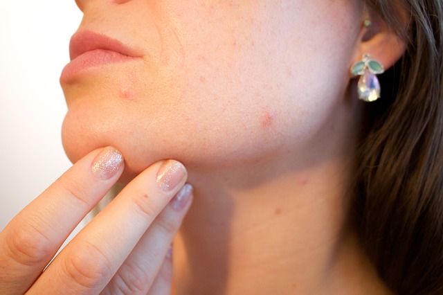 Blog - DERMATOLOŠKE ORDINACIJE: Kožne bolesti kojih ima najviše