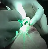 dr-ciric-estetska-i-plasticna-hirurgija-laser-centar