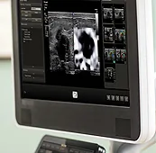 eurodijagnostika-dijagnosticki-centar-ultrazvucna-dijagnostika