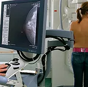 fmms-onkomedikus-ordinacija-za-radiologiju-i-onkologiju-mamografija