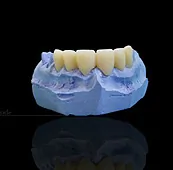 zubotehnicka-laboratorija-strong-dent-zubnotehnicke-laboratorije