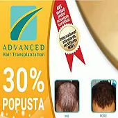 advance-hair-transplantation-aht-transplantacija-kose